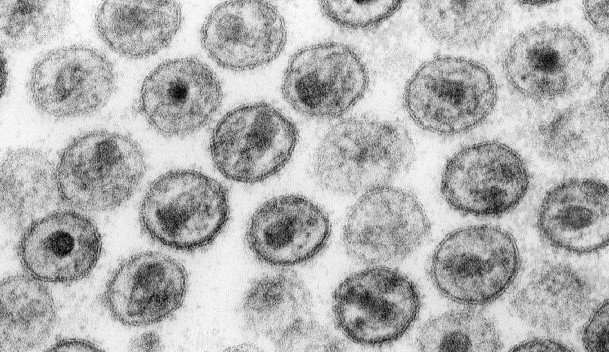 Virus HIV pod elektronovým mikroskopem