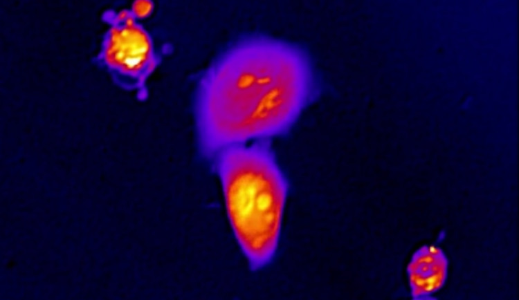 ilustrační foto, zdroj: Masarykova univerzita