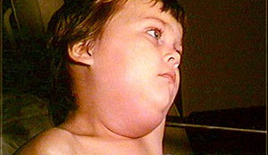 příušnice, foto: Wikipedie.org