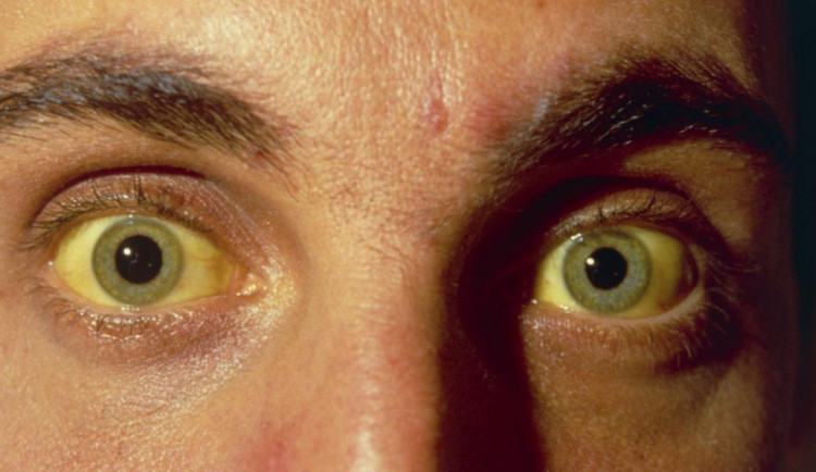 ilustrační foto, zdroj: Česká televize