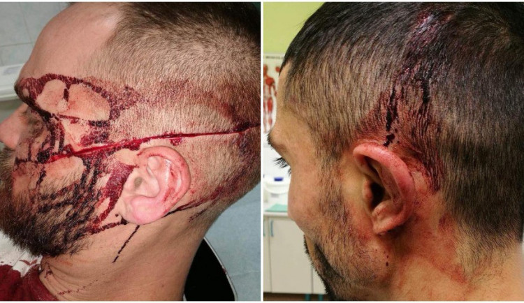 Zdroj: facebook, Martin Korec