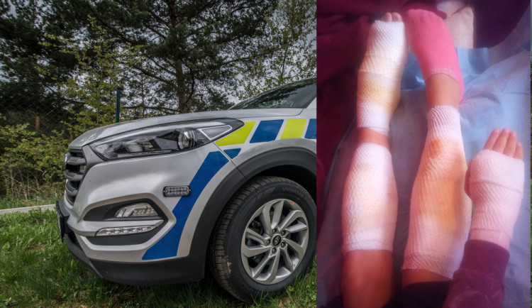 Pes, který pokousal dívku, je v útulku. Majitelka pravděpodobně skončí před soudem