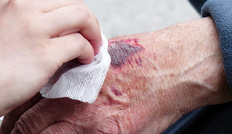 Mladý útočník napadl muže. Nejdřív ho zmlátil, pak ho pokousal