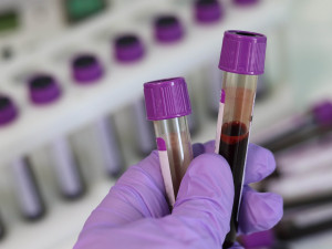 Uherskohradišťská nemocnice vyloučila nakažení koronavirem u pacienta z Hulína