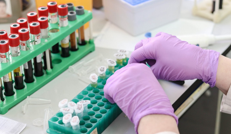 Česká společnost AIDS pomoc obnovila testování HIV v pevných CheckPointech