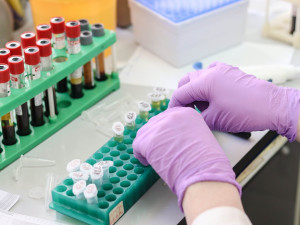 Česká společnost AIDS pomoc obnovila testování HIV v pevných CheckPointech