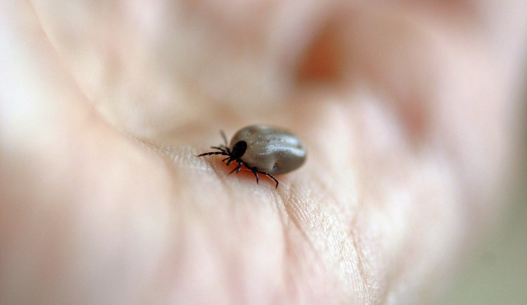 Nakažených encefalitidou a boreliózou stále přibývá, lidé by měli být více obezřetní