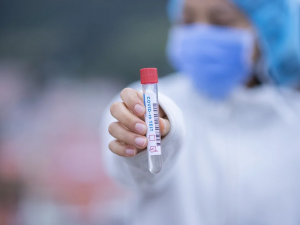 Za poslední tři dny přibylo na jižní Moravě 1440 pozitivně testovaných na koronavirus. Fakultní nemocnice omezuje vstup do areálu