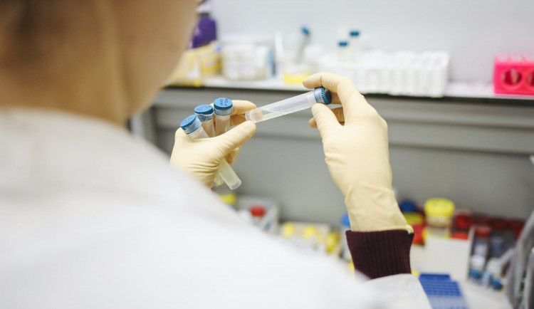 Za minulý týden objevila Fakultní nemocnice sto případů nákazy britskou mutací koronaviru
