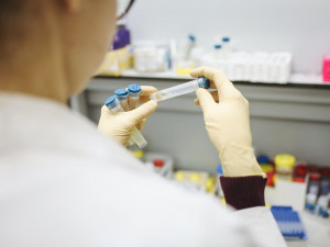 Za minulý týden objevila Fakultní nemocnice sto případů nákazy britskou mutací koronaviru