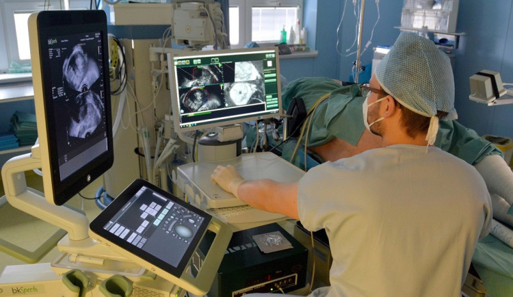 Nový ultrazvuk pomůže s léčbou rakoviny prostaty