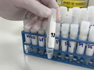Žvýkací tampon jako test na covid, novou metodu vyhodnocují v brněnské laboratoři