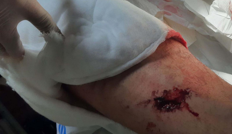 Brutální napadení na Vyškovsku. Agresor zmlátil muže na lavičce a poštval proti němu psa