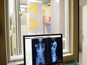 Brněnští lékaři mají jako první v Česku 3D rentgen s nízkou dávkou záření