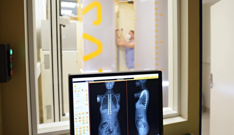 Nový rentgenový systém EOS