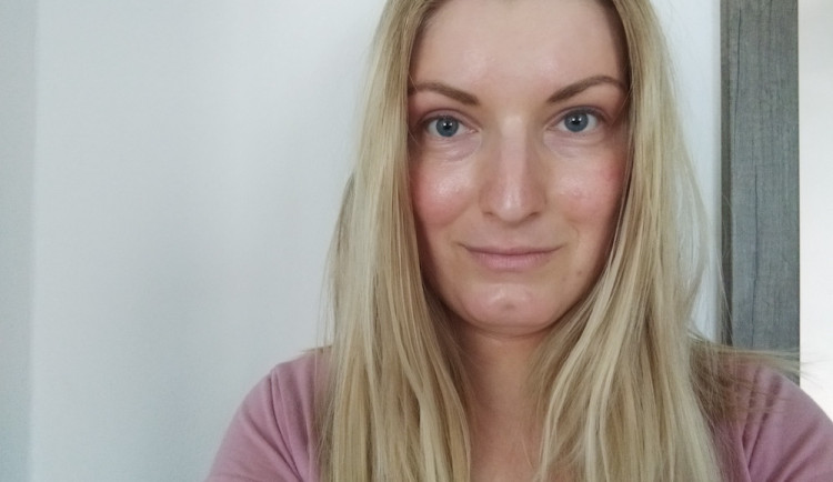 Atopický ekzém se mi objevuje téměř po celém těle. Nejhorší je stres, říká Veronika Seberová