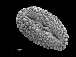 Užijte si Dny elektronové mikroskopie, poznejte hrdiny mikrosvěta