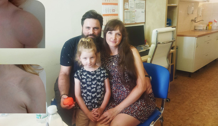 Verunku od narození trápila boule na ruce, pomohla až operace