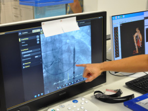 Lékaři v Brně pomáhají lidem se srdeční vadou. Novou chlopeň vymění za tři čtvrtě hodiny
