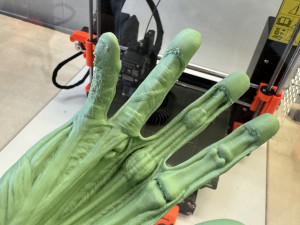 Lékaři v Brně používají 3D modely kostí a orgánů, aby lépe operovali