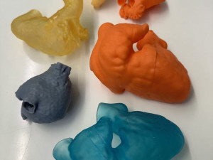 Lékaři v Brně používají 3D modely kostí a orgánů, aby lépe operovali