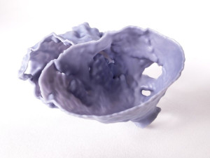 Nemocnice v Brně otevřela centrum, kde lékaři tisknou kosti i části srdce