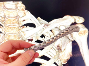 Nemocnice v Brně otevřela centrum, kde lékaři tisknou kosti i části srdce