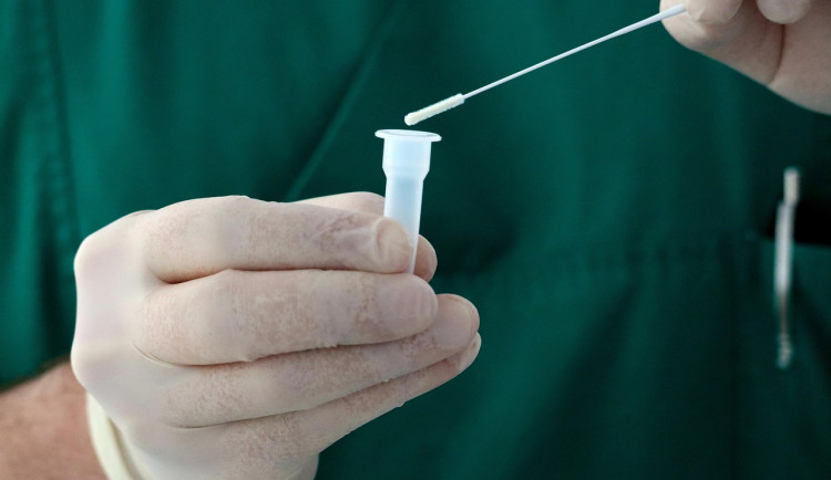 Vědci z Brna vyvíjejí přenosnou laboratoř, která odhalí infekční nemoci