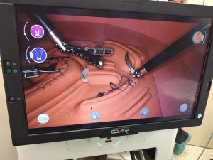 Lékaři v Brně povolají na sál nového robota. Pomůže při operacích plic a střev