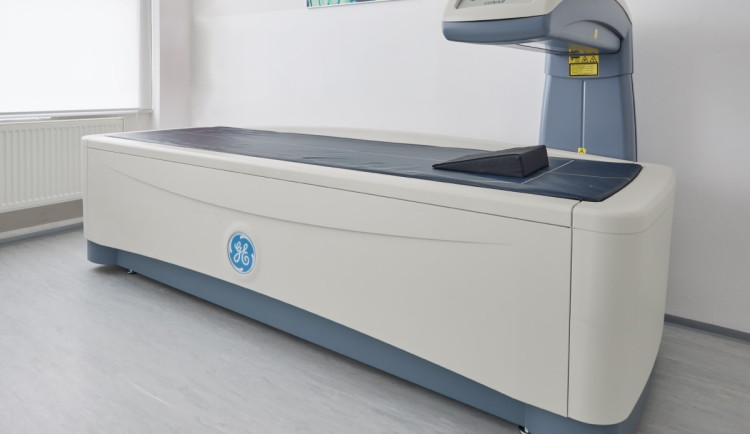 Odhalte zloděje kostí včas. Denzitometrie v Brně diagnostikuje osteoporózu rychle a bezbolestně