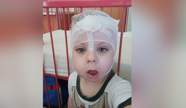 size3-17128459748572-231-dominik-se-narodil-se-tremi-ousky-lekari-u-nej-objevili-vzacne-onemocneni