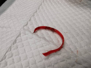 Mladý ježek se málem uškrtil na kroužku z plastové lahve. Pomohli mu odborníci z brněnské univerzity