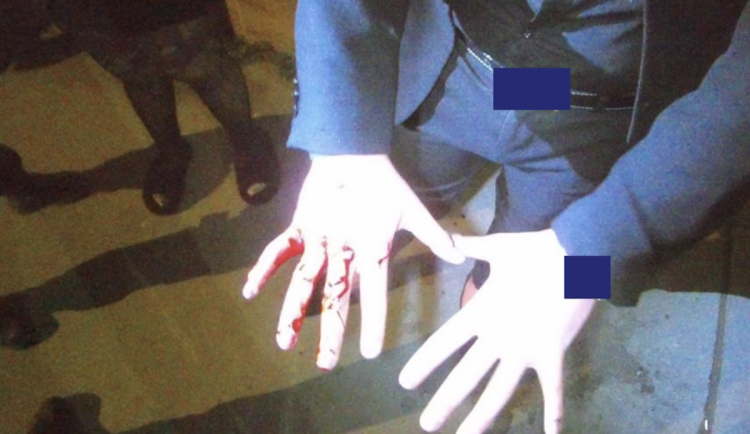 Mladíka naštvala hádka s kamarádkou. Pokusil se uklidnit rozbitím prosklených dveří