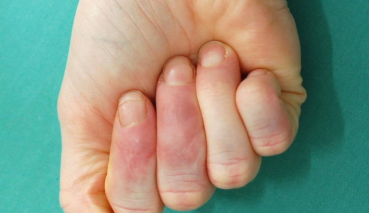 Ilustrační fotografie