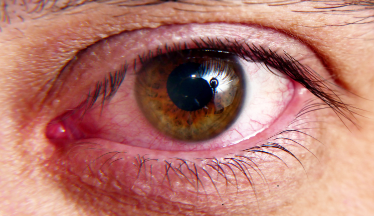 Léto je náročné i pro naše oči. Jak je správně chránit?