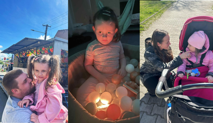 Emička trpí vážnou formou epilepsie. Denně má i 100 záchvatů bleskových křečí