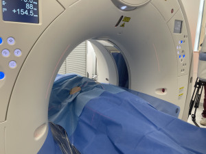 Hybridní přístroj v Masarykově onkologickém ústavu zvládne více vyšetření najednou