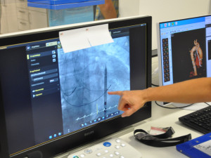 FOTO: Lékaři v Brně pomáhají lidem se srdeční vadou. Letos vyměnili 250 chlopní