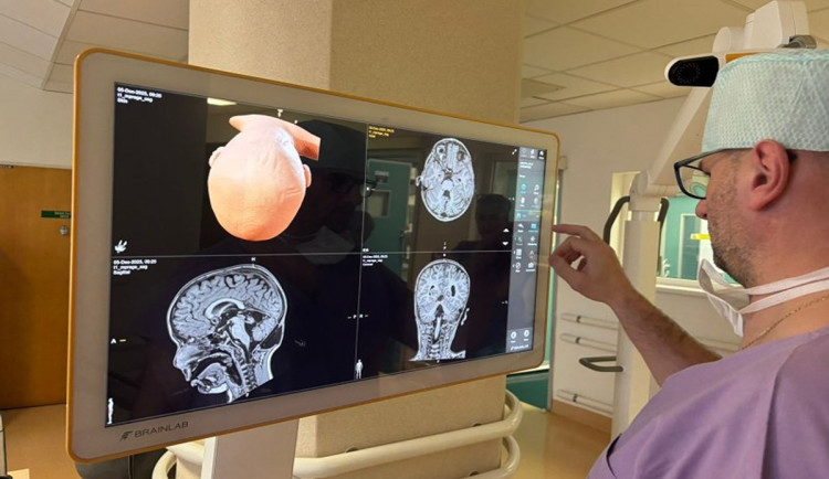Brněnští neurochirurgové budou operovat s novými navigačními systémy