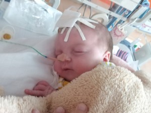 Dianka se narodila s vážnou anomálií v ústech, nemoc nemá v Česku ani pojmenování