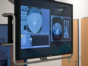 Brněnští lékaři zachránili pacienta s nádorem před ochrnutím. Zabrala nová metoda