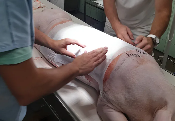 K léčbě poraněné kůže pomáhají náplasti s rybím olejem, objevili brněnští vědci