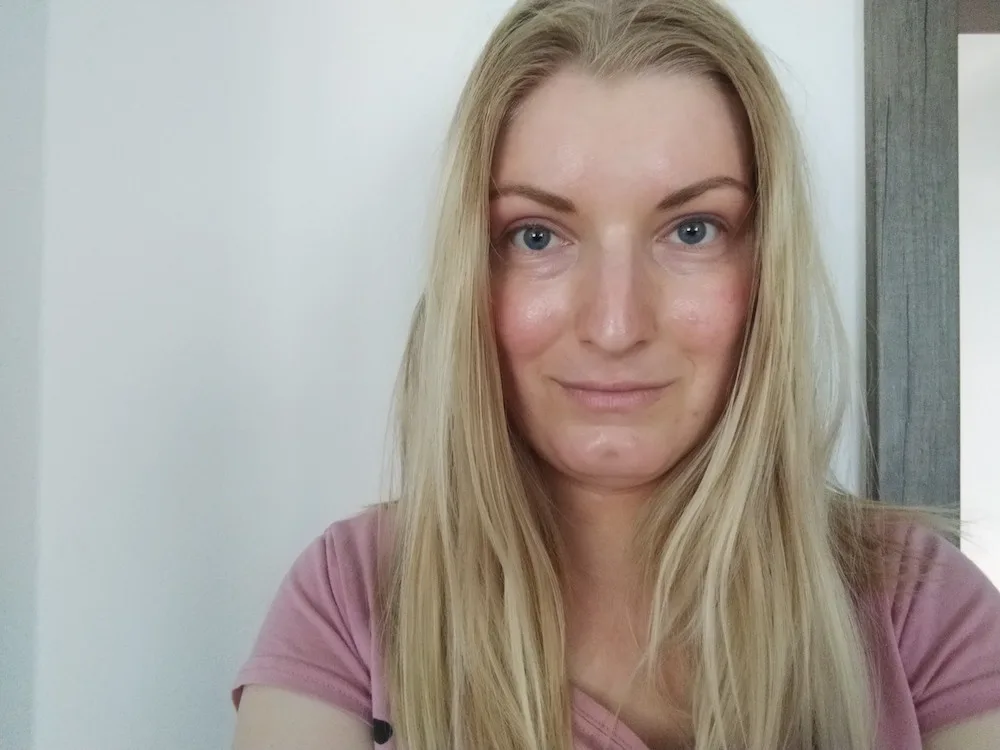 Atopický ekzém se mi objevuje téměř po celém těle. Nejhorší je stres, říká Veronika Seberová