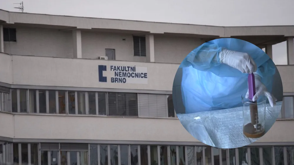 V Brně pomáhají lidem se zánětem střev transplantací stolice