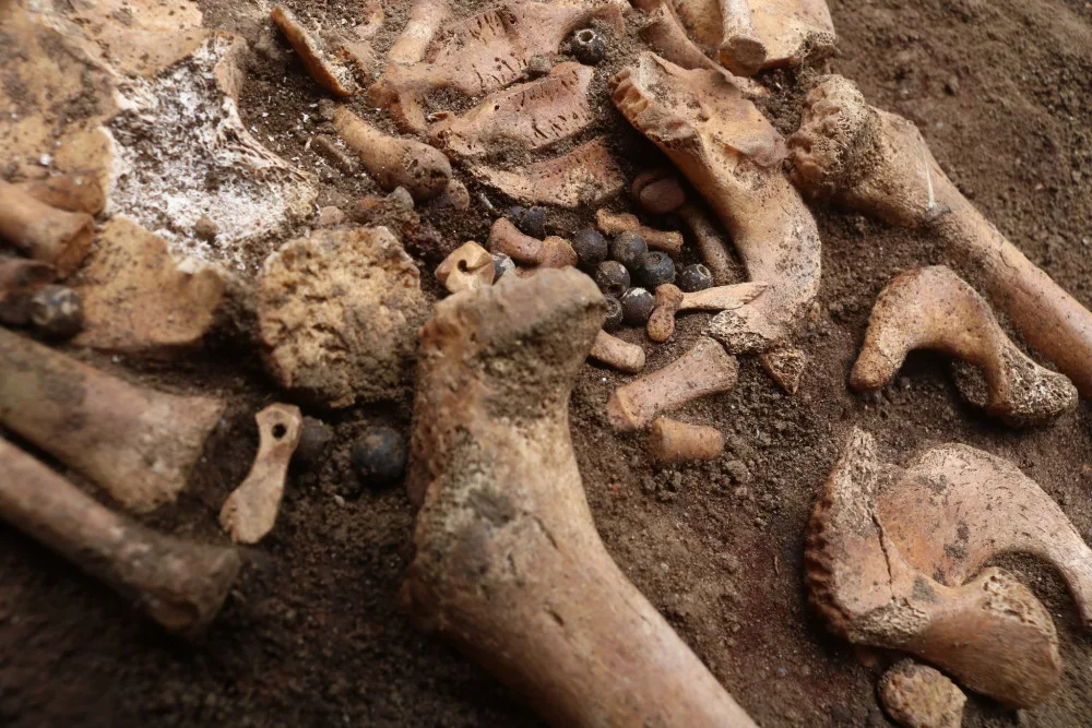 Archeologové přišli s překvapivým zjištěním. Lidé na jižní Moravě trpěli dlouho infekcemi nohou