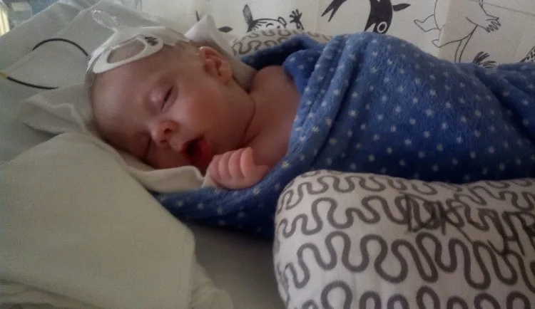 Dominik se narodil se třemi oušky a rozštěpem rtu, lékaři u něj objevili vzácné onemocnění