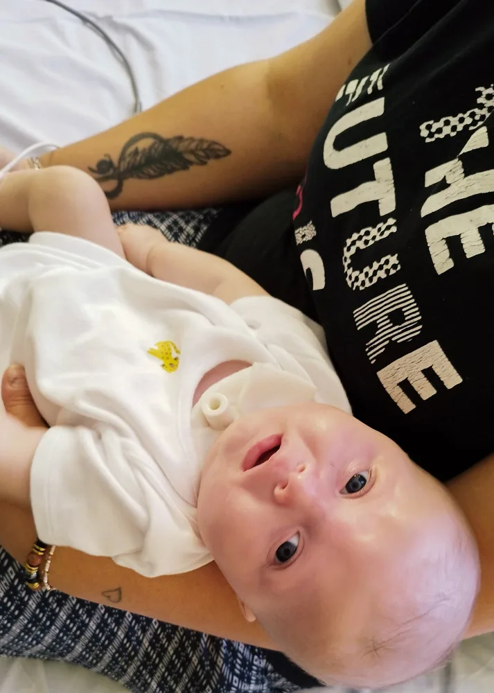 Vdechl plodovou vodu a prodělal tracheostomii. Půlroční Jiříček teď potřebuje speciální péči ve vzdálené nemocnici