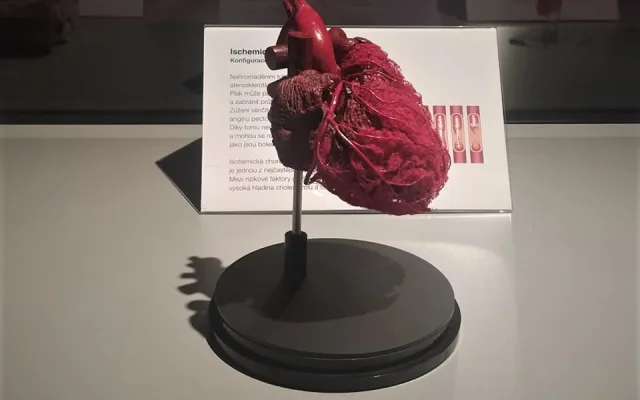 K vidění je preparát lidského srdce