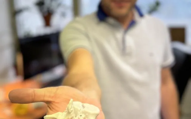 Lékaři v Brně používají 3D modely kostí a orgánů, aby lépe operovali