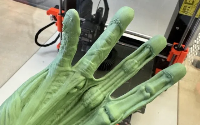 Lékaři v Brně používají 3D modely kostí a orgánů, aby lépe operovali